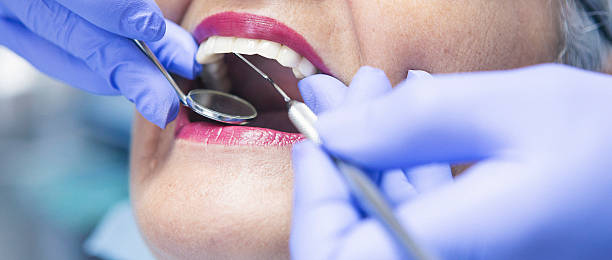 Best Broken or Cracked Tooth Emergency Dentist in Lagrange, IN